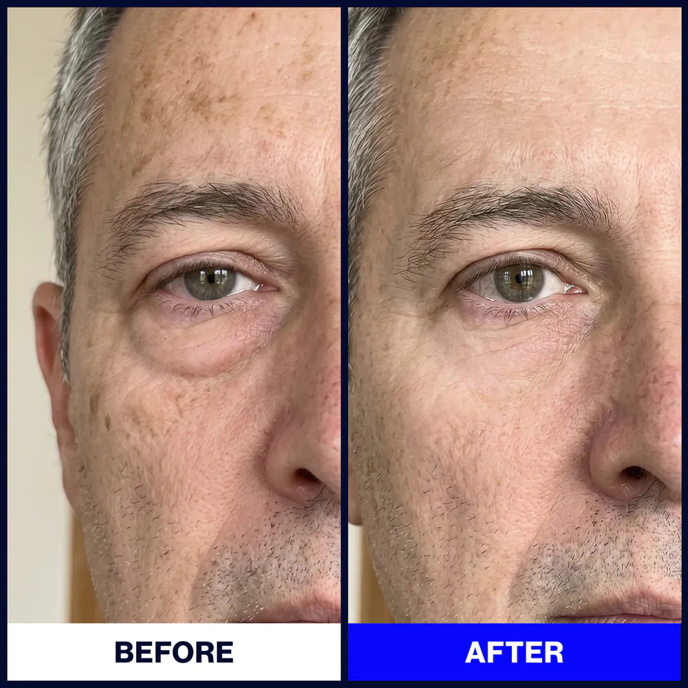 Particle & Face Cream