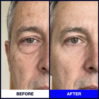 Particle & Face Cream